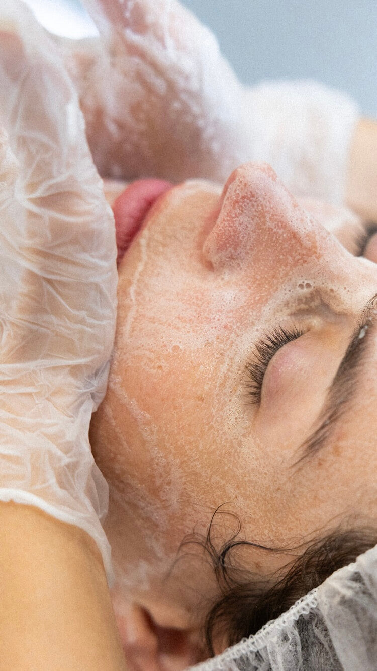 Why Adult Acne and Teenage Acne Shouldn't Be Treated The Same Way